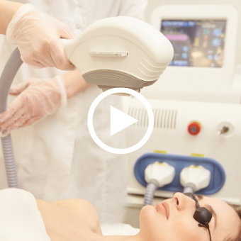 laser procedure