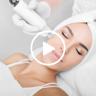 Woman receives RF treatment on her cheek